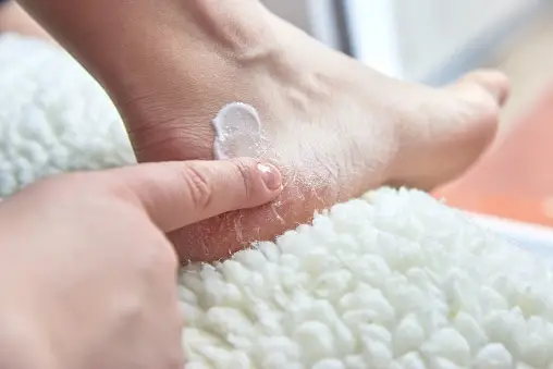 pedicure at home for dry feet
